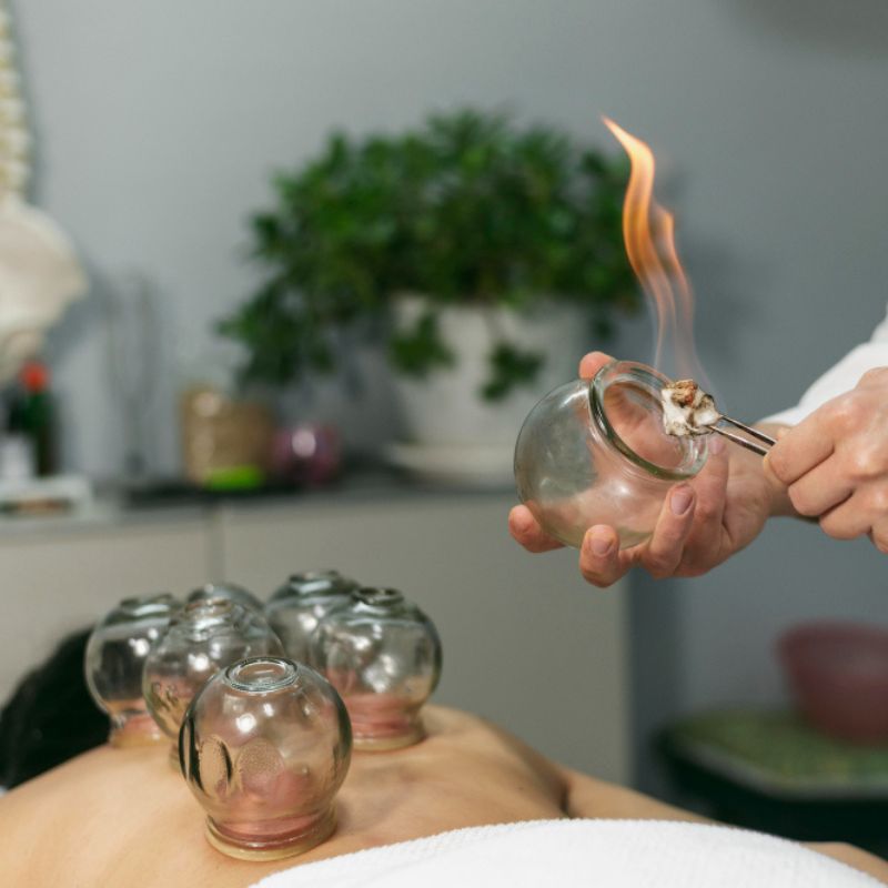 Cupping Therapy in Surrey BC